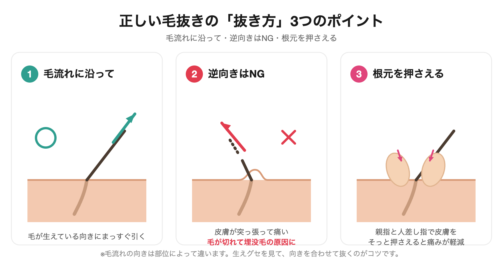 毛抜きの正しい抜き方｜毛流れに沿って抜く・逆方向はNG・根元を指で押さえるの図解