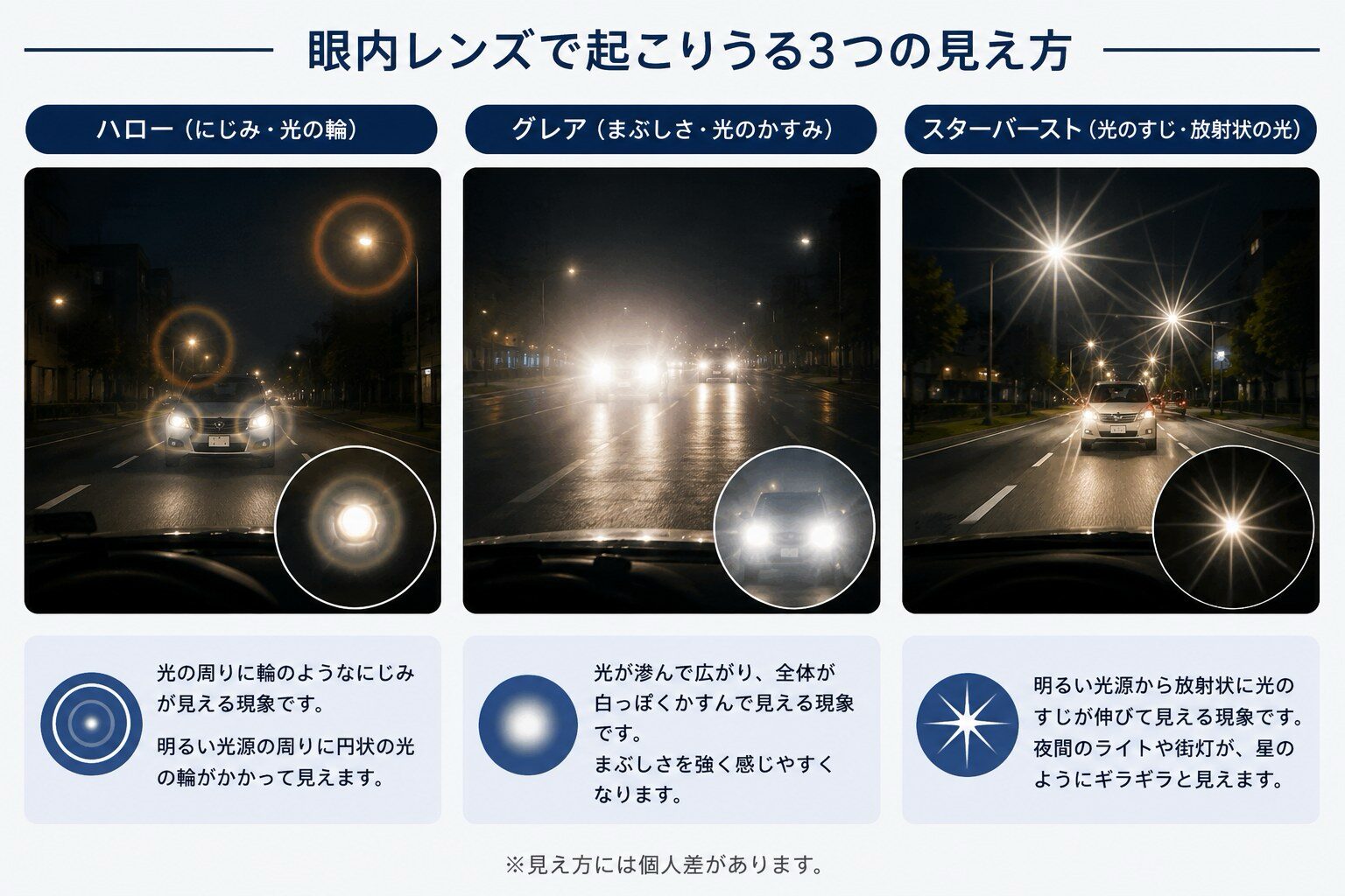 眼内レンズで起こりうるハロー・グレア・スターバーストの3つの見え方を説明する図解